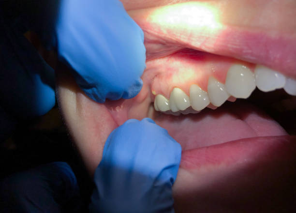 Best 24-Hour Emergency Dental Care in Ponderosa Pine, NM